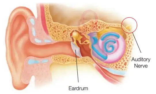 understanding and recognizing auditory deprivation